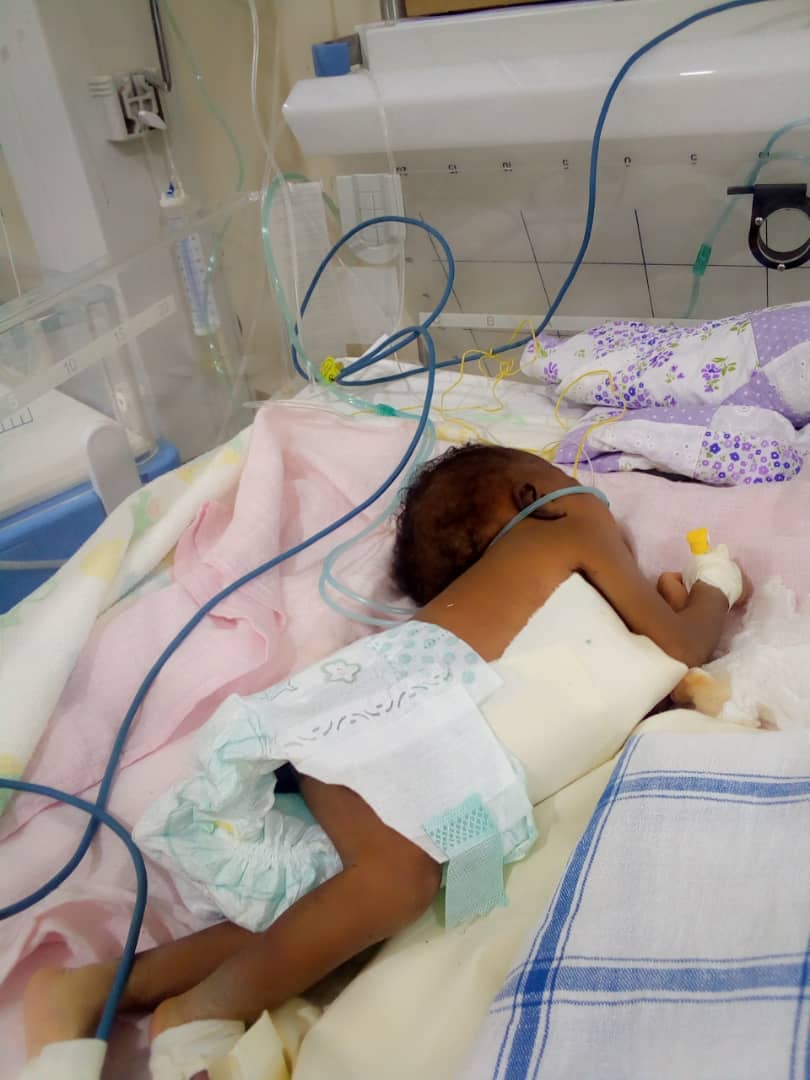 Mulago now fights to take control of Siamese twin they refused to separate