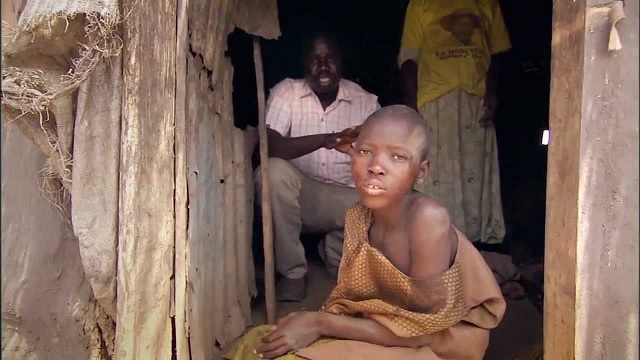 Families plead with gov’t to reopen nodding syndrome treatment centers