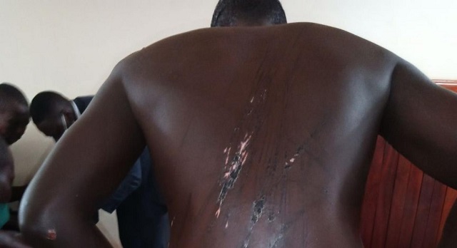 How the State kills its cases through torture of suspects