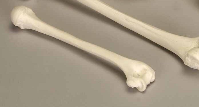 Couple, businesswoman arrested in Kalungu for trading in human bones