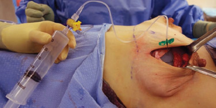 Uganda probes into internal organs harvesting