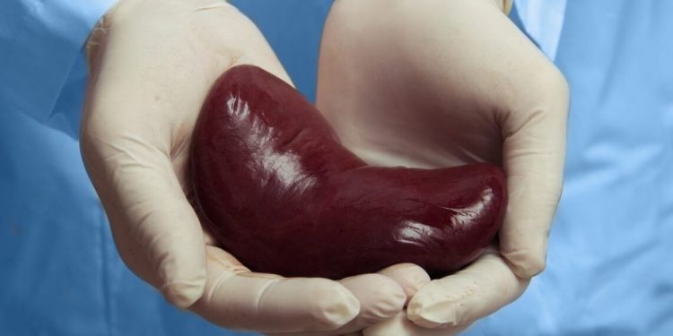 Now gov’t moves to allow Enrica Pinetti’s Lubowa hospital to extract body organs