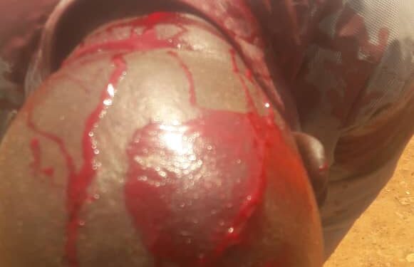 Bloodbath in Ham, Veterans fight for Wakaliga KCCA land