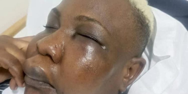 FULL FIGURE BEATING: HATERS PARTY AS POLICE INVESTIGATES PRESIDENTIAL ADVISOR