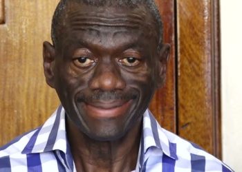 FRESH FEARS AS DR . BESIGYE ‘S HEALTH DETERIORÀTES