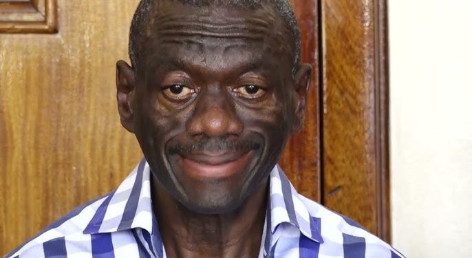 FRESH FEARS AS DR . BESIGYE ‘S HEALTH DETERIORÀTES