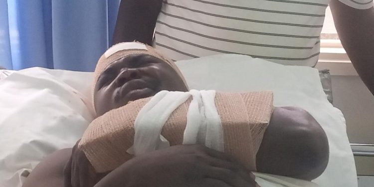 Medical report says MP Zaake’s arm fractured in SFC soldiers’ attack