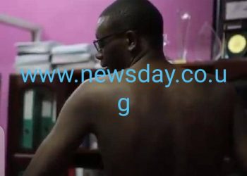 Video: It’s horror as Kakwenza strips to show state security torture marks.