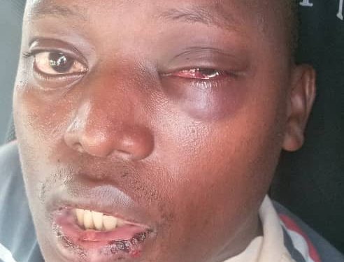 Awonye aba KCCA okumuwangulamu amanyo