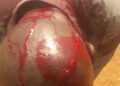 Bloodbath in  Ham, Veterans fight for Wakaliga KCCA land